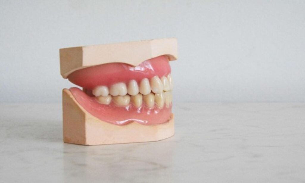 Segera Hentikan, Ini 5 Kebiasaan yang Dapat Membuat Gigi Berantakan